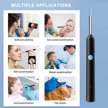 Smart Ear Cleaning Camera Device -Safe Ear Wax Removal Tool Compatible with Smartphones