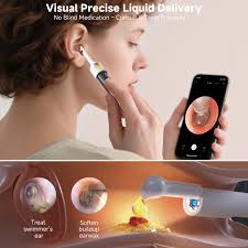Smart Ear Cleaning Camera Device -Safe Ear Wax Removal Tool Compatible with Smartphones